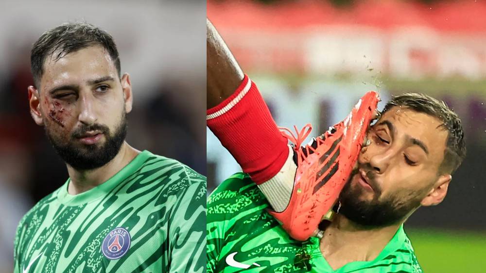 إصابة دوناروما الخطيرة ضد موناكو